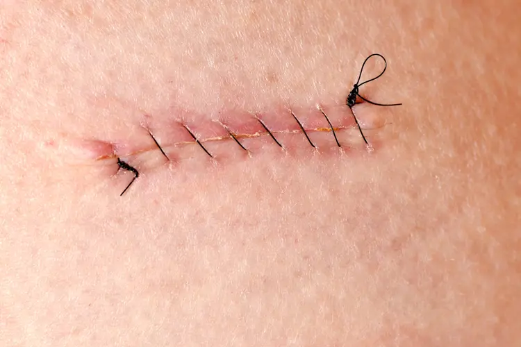Serivce Image